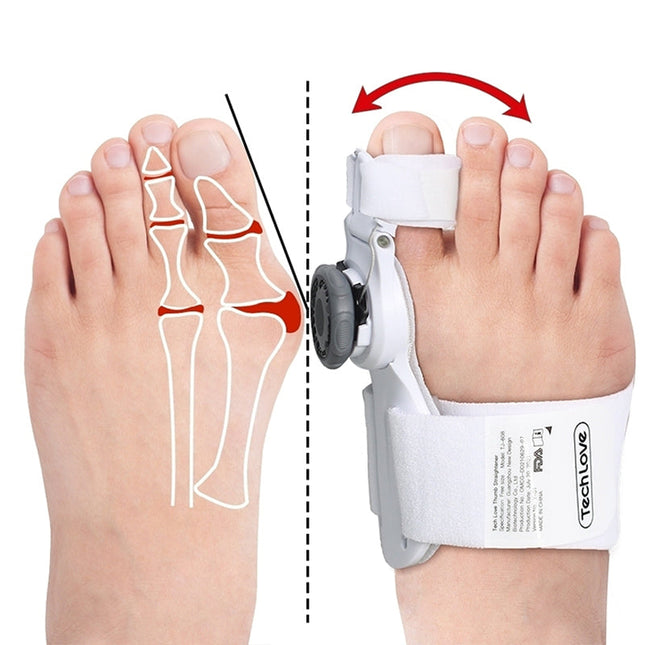 Upgraded 3D Knob Toe Alignment Device | Natural Position Correction | Adjustable Angle for Valgus Repair | High-Quality Material | Multi-Size Compatibility
