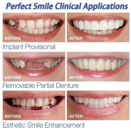 Instant Smile Snap-On Veneers | Upper & Lower Set | Natural Looking Teeth Cover | Disguise Crooked, Stained, Missing & Gapped Teeth | Comfortable Fit | Unisex | Safe & Easy to Use | One Size Fits Most
