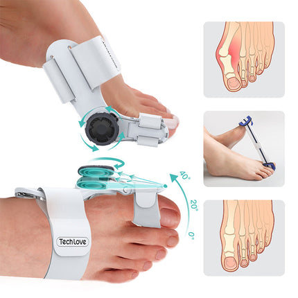 Upgraded 3D Knob Toe Alignment Device | Natural Position Correction | Adjustable Angle for Valgus Repair | High-Quality Material | Multi-Size Compatibility
