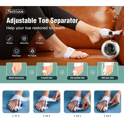 Upgraded 3D Knob Toe Alignment Device | Natural Position Correction | Adjustable Angle for Valgus Repair | High-Quality Material | Multi-Size Compatibility