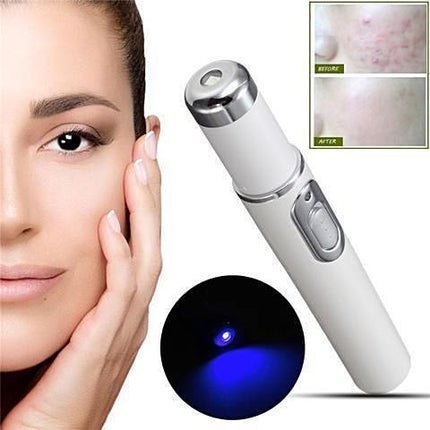 Blue Light Laser Treatment Pen | Removes Spots & Scars | Home Use | Thermal Therapy | For Skin Tags | Age Spots | Birthmark | Skin Pigmentation | No Side Effects | High-Tech Ion Function | Clear Skin