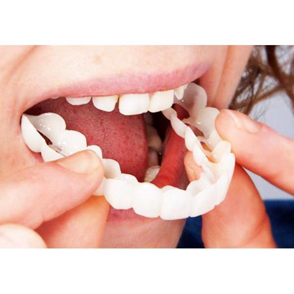 Instant Smile Snap-On Veneers | Upper & Lower Set | Natural Looking Teeth Cover | Disguise Crooked, Stained, Missing & Gapped Teeth | Comfortable Fit | Unisex | Safe & Easy to Use | One Size Fits Most