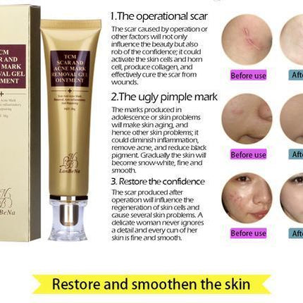 Ginseng Extract Acne Scar Cream | Reduce Pimples & Marks | Restore & Smooth Skin | Personal Care