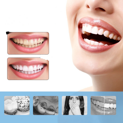 FreshWhite | 6-Speed Electric Teeth Whitening Device | Advanced Plaque & Stain Scaler | Waterproof Design | Type-C Rechargeable Oral Care Tool | Professional-Level Whitening | Adjustable Speed Settings