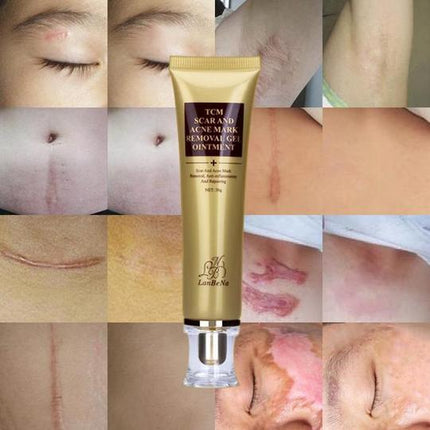 Ginseng Extract Acne Scar Cream | Reduce Pimples & Marks | Restore & Smooth Skin | Personal Care