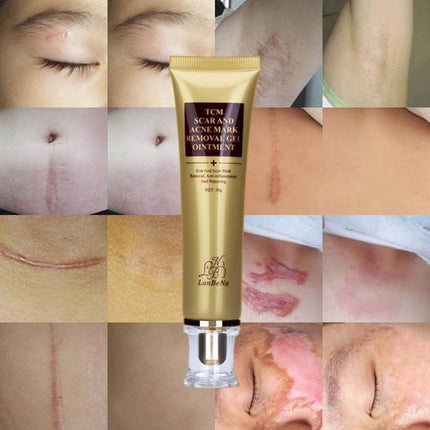 Ginseng Extract Acne Scar Cream | Reduce Pimples & Marks | Restore & Smooth Skin | Personal Care