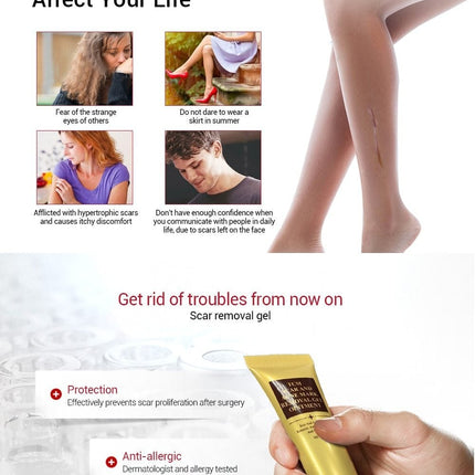 Ginseng Extract Acne Scar Cream | Reduce Pimples & Marks | Restore & Smooth Skin | Personal Care