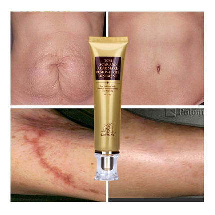 Ginseng Extract Acne Scar Cream | Reduce Pimples & Marks | Restore & Smooth Skin | Personal Care