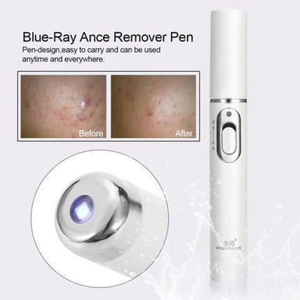 Blue Light Laser Treatment Pen | Removes Spots & Scars | Home Use | Thermal Therapy | For Skin Tags | Age Spots | Birthmark | Skin Pigmentation | No Side Effects | High-Tech Ion Function | Clear Skin