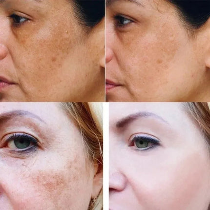 Turmeric Glow Enhancing Serum | Curcuma Skincare | Dark Spot Corrector | Natural Ingredients | 30ml | Antioxidant Enriched Formula | Brightens & Evens Skin Tone | Anti-Aging Hydration | Facial Serum